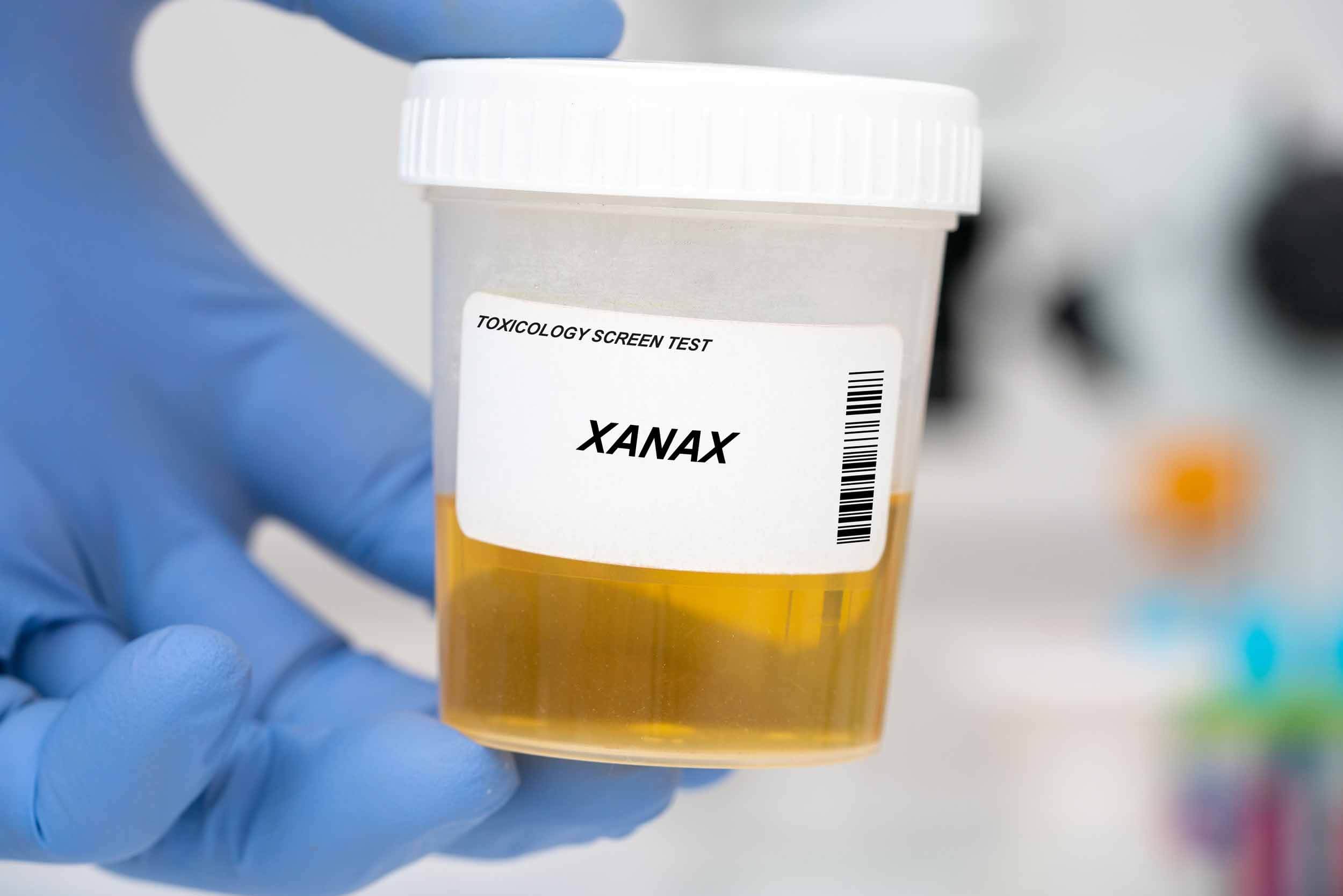 How long does Xanax stay in your system?