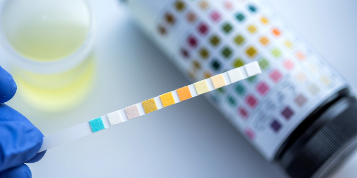 Drug Tests: How they work and why you need to take one