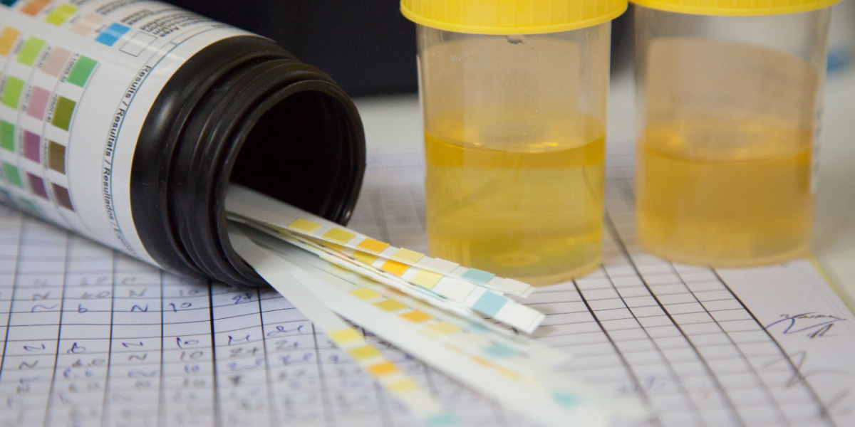Exploring the Effectivity of Drug Detox Drinks and Its Dangers