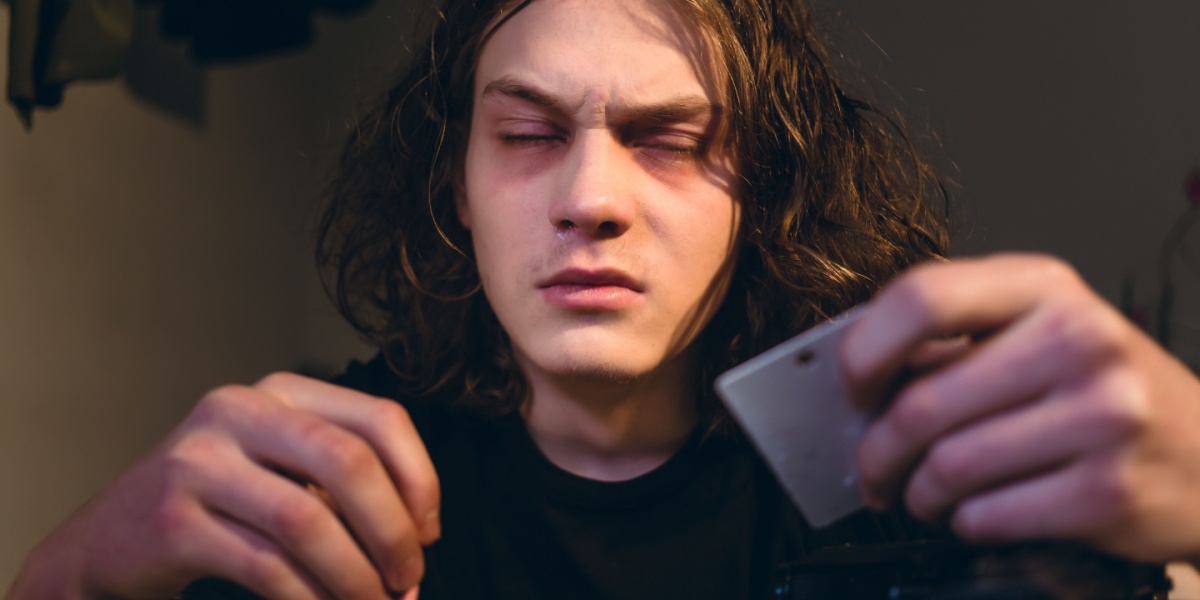 a close up photo of a caucasian man's face affected by cocaine use