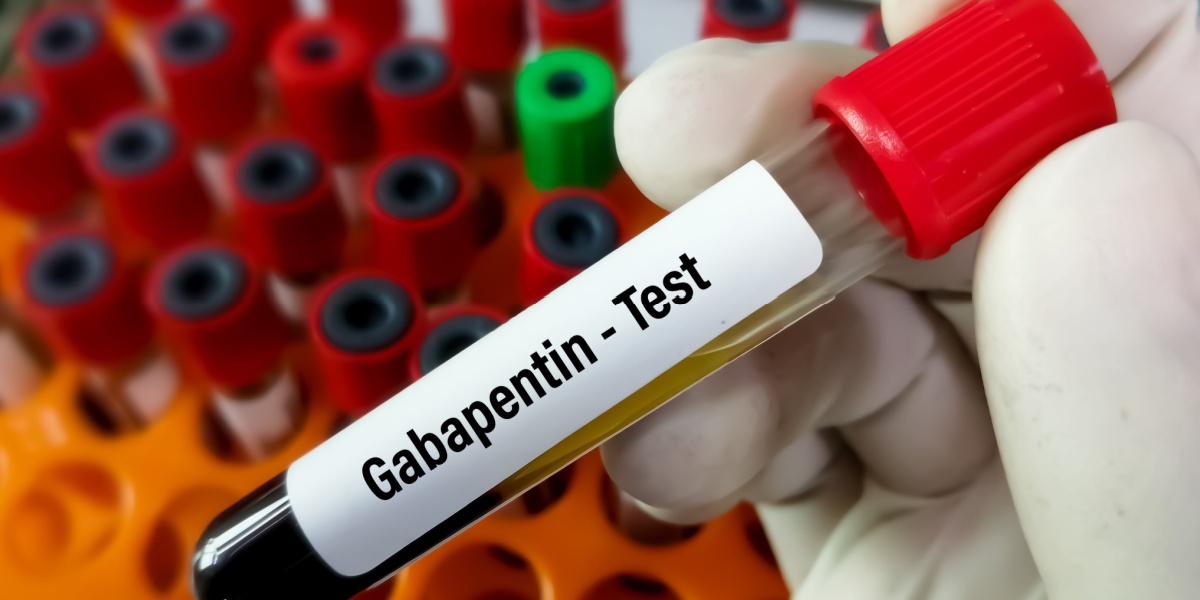 a close up photo of a hand holding up a blood specimen labeled Gabapentin test
