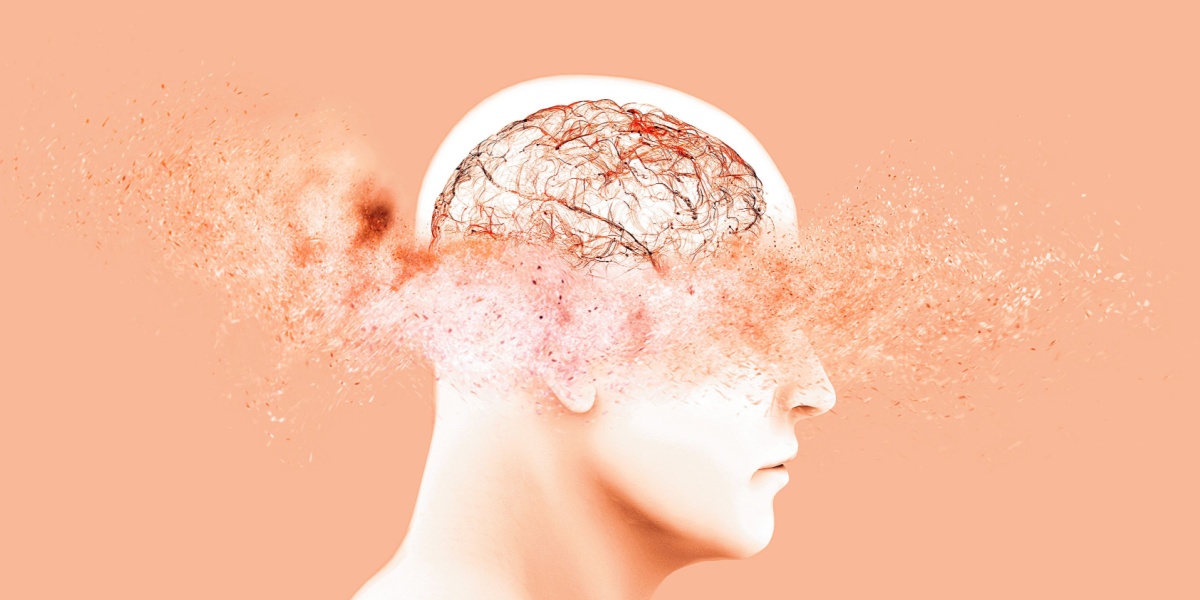 Wernicke-Korsakoff Syndrome