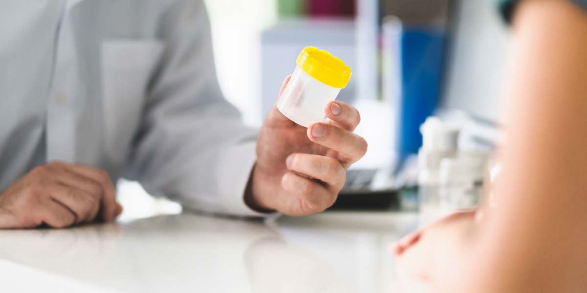 a close up photo of a healthcare worker holding up a urine container and explaining to a patient about drug testing
