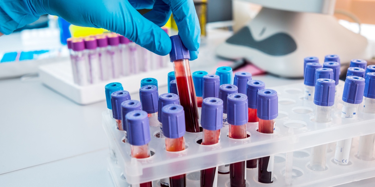 a close up photo of a tray of test tubes filled with blood samples for a drug test