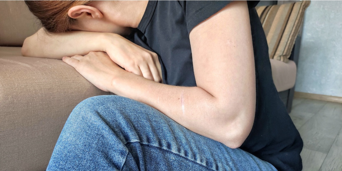 Non‑Suicidal Self‑Injury, Anxiety, and Substance Use in University Populations