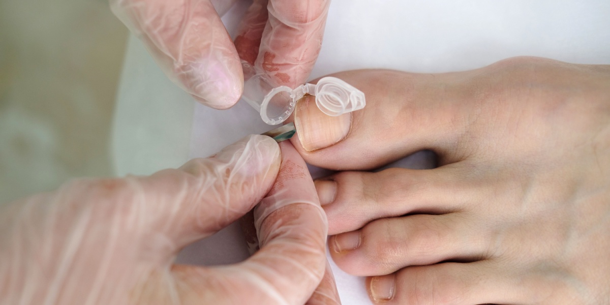 Nail Drug Testing